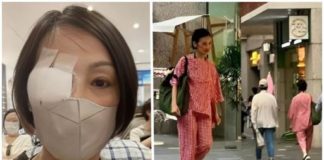 「女港星」剛做完手術就北上逛街!衣品狀態「一言難盡」