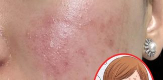 這3種洗面乳「已被列為黑名單」!長期用「直接變爛臉」有的快丟掉