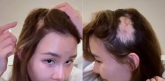 富豪馬清鏗情婦曬斑禿畫面!頭上兩大塊好明顯,十年誕下四個兒女