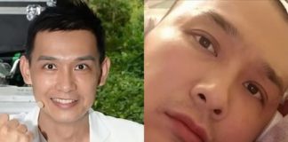TVB兒童節目主持人不幸確診腦癌,接受開顱手術,努力康復后再度復出