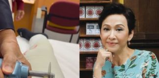 香港資深女星一年內兩度骨裂,膝蓋打石膏兩周,睡覺都受影響